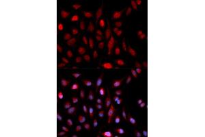 Immunofluorescence (IF) image for anti-Set1/Ash2 Histone Methyltransferase Complex Subunit ASH2 (ASH2L) antibody (ABIN1876580) (ASH2L antibody)