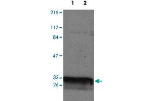 Western blot analysis of YWHAQ expression in HeLa (Lane 1) and Jurkat (Lane 2) whole cell lysates. (14-3-3 theta antibody)