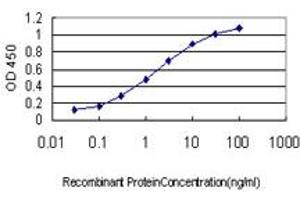 Detection limit for recombinant GST tagged IRAK2 is approximately 0. (IRAK2 antibody  (AA 111-210))