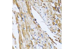Immunohistochemistry of paraffin-embedded rat heart using GOLM1 antibody. (GOLM1 antibody  (AA 112-401))