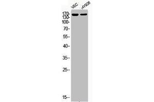 Western Blot analysis of VEC HY929 cells using Phospho-HDAC5 (S498) Polyclonal Antibody (HDAC5 antibody  (pSer498))