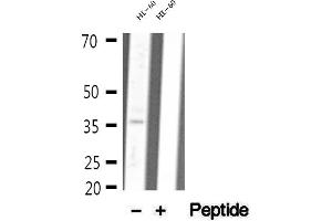Western blot analysis of extracts of HL-60 cells, using MDH1 antibody.