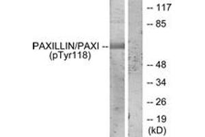 Western blot analysis of extracts from HeLa cells treated with EGF, using Paxillin (Phospho-Tyr118) Antibody. (Paxillin antibody  (pTyr118))