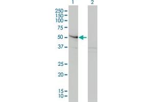 Western Blot analysis of SMAD3 expression in transfected 293T cell line by SMAD3 monoclonal antibody (M01), clone 2C12. (SMAD3 antibody  (AA 120-221))