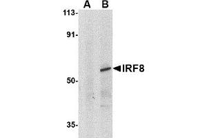 Western blot analysis of IRF8 in human thymus tissue lysate with AP30451PU-N IRF8 antibody at 1μg/ml in (A) the presence and (B) absence of blocking peptide.