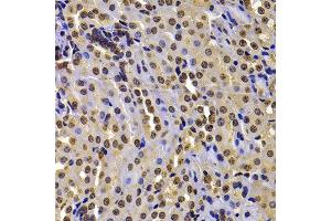 Immunohistochemistry of paraffin-embedded mouse kidney using WHSC1 antibody at dilution of 1:100 (40x lens). (WHSC1 antibody)