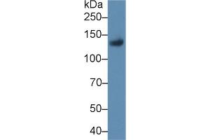 Western blot analysis of Rat Placenta lysate, using Rat LIFR Antibody (1 µg/ml) and HRP-conjugated Goat Anti-Rabbit antibody ( (LIFR antibody  (AA 642-791))