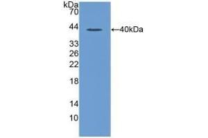 Detection of Recombinant MIP1a, Rat using Polyclonal Antibody to Macrophage Inflammatory Protein 1 Alpha (MIP1a) (CCL3 antibody  (AA 24-92))