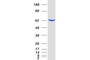 Validation with Western Blot (EPHX2 Protein (Myc-DYKDDDDK Tag))