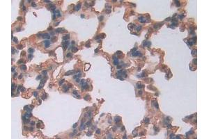 DAB staining on IHC-P; Samples: Rat Lung Tissue (LCNL1 antibody  (AA 2-164))