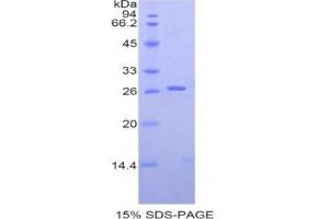 SDS-PAGE analysis of Human SIGLEC2 Protein.