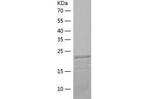 Western Blotting (WB) image for RAB4A, Member RAS Oncogene Family (RAB4A) (AA 1-218) protein (His tag) (ABIN7285607) (Rab4 Protein (AA 1-218) (His tag))