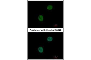 Immunofluorescence (IF) image for anti-Guanine Nucleotide Binding Protein (G Protein), alpha Transducing Activity Polypeptide 2 (GNAT2) (Center) antibody (ABIN2856958)