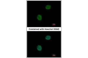 ICC/IF Image Immunofluorescence analysis of paraformaldehyde-fixed HeLa, using GNAT2, antibody at 1:500 dilution. (GNAT2 antibody  (Center))