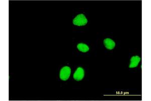 Immunofluorescence of monoclonal antibody to ZNF323 on HeLa cell. (Zinc Finger and SCAN Domain Containing 31 (ZSCAN31) (AA 1-209) antibody)