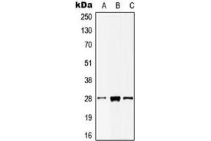 Western blot analysis of MOB2 expression in HepG2 (A), mouse liver (B), rat testis (C) whole cell lysates. (MOB2 antibody  (N-Term))