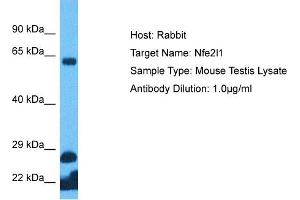 Host: Rabbit Target Name: NFE2L1 Sample Tissue: Mouse Testis Antibody Dilution: 1ug/ml (NFE2L1 antibody  (C-Term))