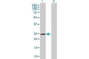 Western Blot analysis of FBXO42 expression in transfected 293T cell line by FBXO42 MaxPab polyclonal antibody. (FBXO42 antibody  (AA 1-716))