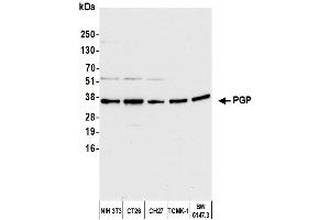 Western Blotting (WB) image for anti-Phosphoglycolate Phosphatase (PGP) (AA 271-321) antibody (ABIN7451551) (PGP antibody  (AA 271-321))