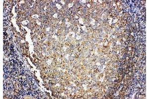 Anti-IL4 antibody, IHC(P) IHC(P): Human Tonsil Tissue (IL-4 antibody  (Middle Region))