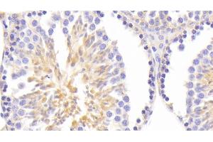 Detection of ASNS in Mouse Testis Tissue using Polyclonal Antibody to Asparagine Synthetase (ASNS) (Asparagine Synthetase antibody  (AA 213-561))