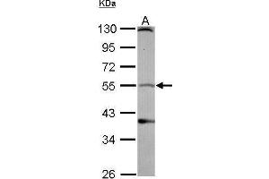 WB Image Sample (30 ug of whole cell lysate) A: IMR32 10% SDS PAGE antibody diluted at 1:1000 (Dopamine Receptor d1 antibody  (N-Term))