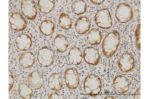 Immunoperoxidase of monoclonal antibody to LASS6 on formalin-fixed paraffin-embedded human colon. (CERS6 antibody  (AA 62-131))