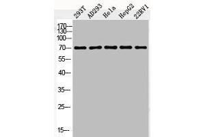Western Blot analysis of 293T AD293 HELA HepG2 22RV1 cells using Phospho-c-Fos (S362) Polyclonal Antibody (c-FOS antibody  (pSer362))