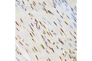 Immunohistochemistry of paraffin-embedded human colonic muscle using KPNA4 Antibody (ABIN5971058) at dilution of 1/200 (40x lens). (KPNA4 antibody)