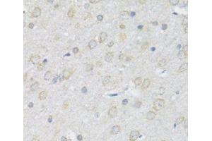 Immunohistochemistry of paraffin-embedded Rat brain using P2RX7 Polyclonal Antibody at dilution of 1:100 (40x lens). (P2RX7 antibody)