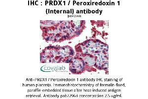Image no. 1 for anti-Peroxiredoxin 1 (PRDX1) (Internal Region) antibody (ABIN1738319)