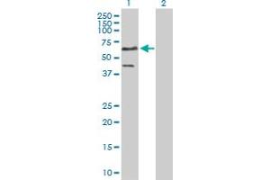 Western Blot analysis of ETS1 expression in transfected 293T cell line by ETS1 MaxPab polyclonal antibody. (ETS1 antibody  (AA 1-441))
