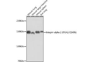 Western blot analysis of extracts of various cell lines, using Integrin alpha 2 (ITG/CD49b) (ITG/CD49b) antibody  at 1:1000 dilution. (ITGA2 antibody)