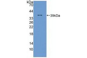 Detection of Recombinant ALOX12, Human using Polyclonal Antibody to Arachidonate-12-Lipoxygenase (ALOX12) (ALOX12 antibody  (AA 352-656))