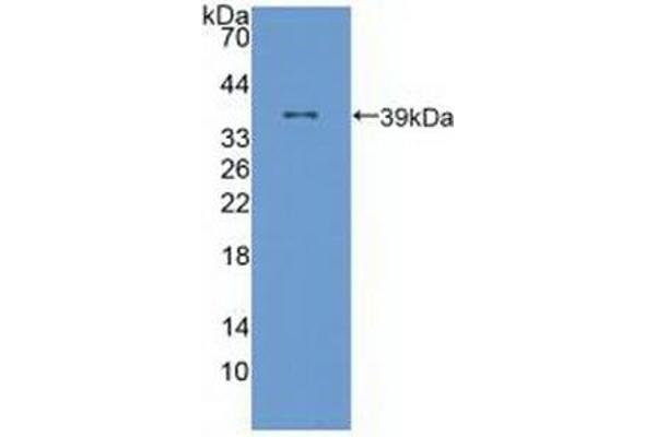 ALOX12 antibody  (AA 352-656)