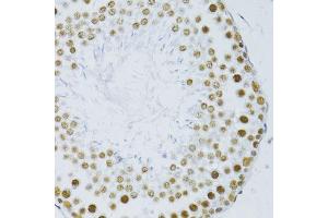 Immunohistochemistry of paraffin-embedded rat testis using SNRNP70 antibody. (SNRNP70 antibody  (AA 150-250))