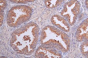 Immunohistochemistry of paraffin-embedded human kidney tissue using ABIN7158090 at dilution of 1:100 (LRRN3 antibody  (AA 201-500))