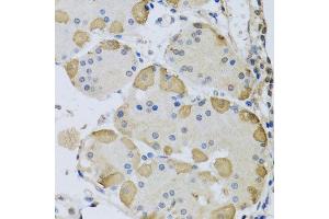 Immunohistochemistry of paraffin-embedded human stomach using ANAPC10 antibody at dilution of 1:100 (x40 lens).