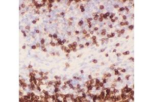 IHC-P staining of rat spleen tissue (CD3 epsilon antibody  (AA 23-207))