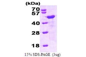 SDS-PAGE (SDS) image for Homer Homolog 1 (HOMER1) (AA 1-354) protein (His tag) (ABIN667102)