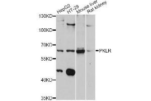 Western blot analysis of extracts of various cell lines, using PKLR antibody (ABIN5998532) at 1:3000 dilution. (PKLR antibody)