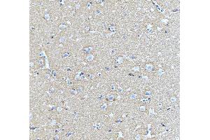 IHC analysis of STXBP1 using anti-STXBP1 antibody (ABIN3043413).