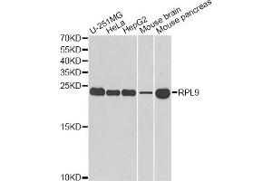 Western blot analysis of extracts of various cell lines, using RPL9 antibody. (RPL9 antibody)