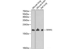 Western blot analysis of extracts of various cell lines using TPPP3 Polyclonal Antibody at dilution of 1:1000. (TPPP3 antibody)