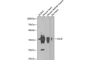 Western blot analysis of extracts of various cell lines, using SGCB antibody (ABIN6131899, ABIN6147697, ABIN6147698 and ABIN6222738) at 1:1000 dilution. (SGCB antibody  (AA 94-318))