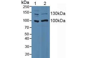 Figure. (ITGA2 antibody  (AA 74-277))