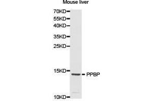 Western Blotting (WB) image for anti-Pro-Platelet Basic Protein (Chemokine (C-X-C Motif) Ligand 7) (PPBP) antibody (ABIN1874208) (CXCL7 antibody)