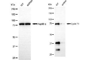 Western blotting analysis using cyclin T1 antibody (ABIN7798203).