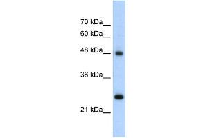 WB Suggested Anti-CHGA Antibody Titration:  5. (Chromogranin A antibody  (N-Term))