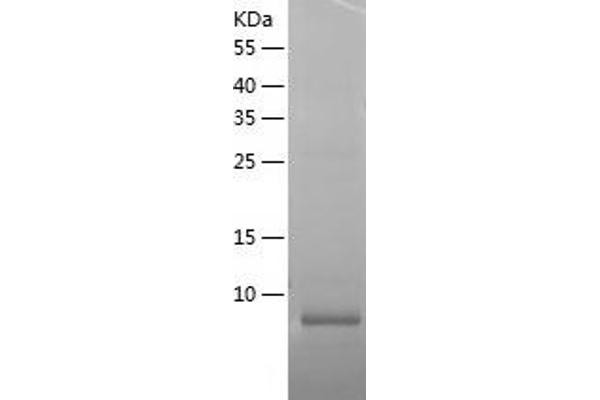 CCL22 Protein (AA 14-81) (His tag)